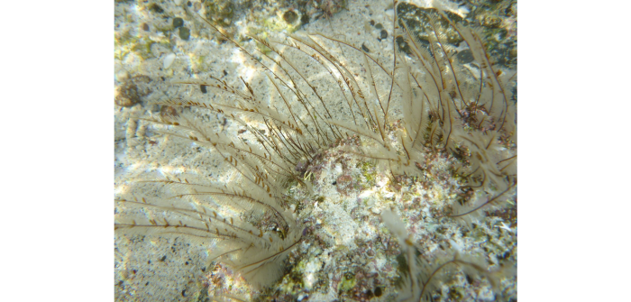 © Robin Gwen Agarwal